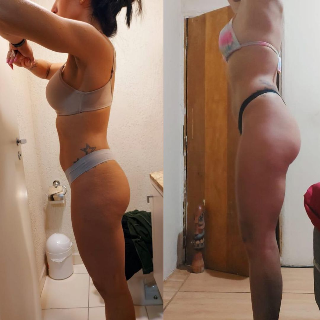 Resultado real - antes e depois