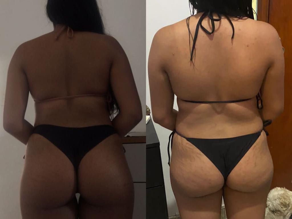 Resultado real - antes e depois